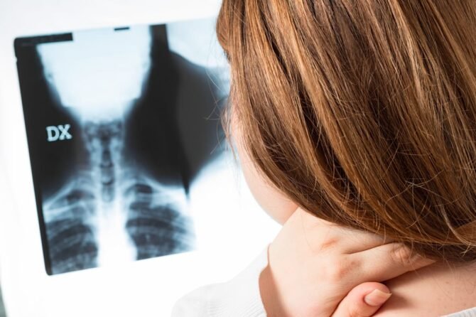 Raideur-cervicale-chiropraxie-arthrose-cervicalgie - Chiropracteur Paris 16 La Chiropraxie pour cervicalgie, raideur cervicale et discopathie